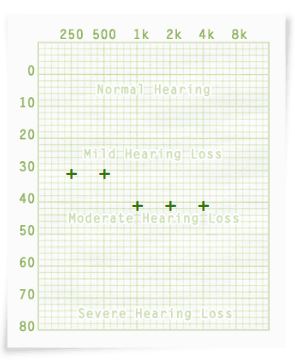 Hearingtest service